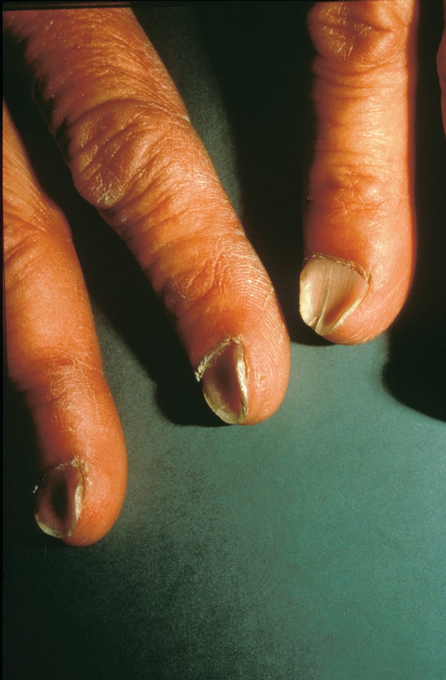 Something to Talk About: Spoon Nails