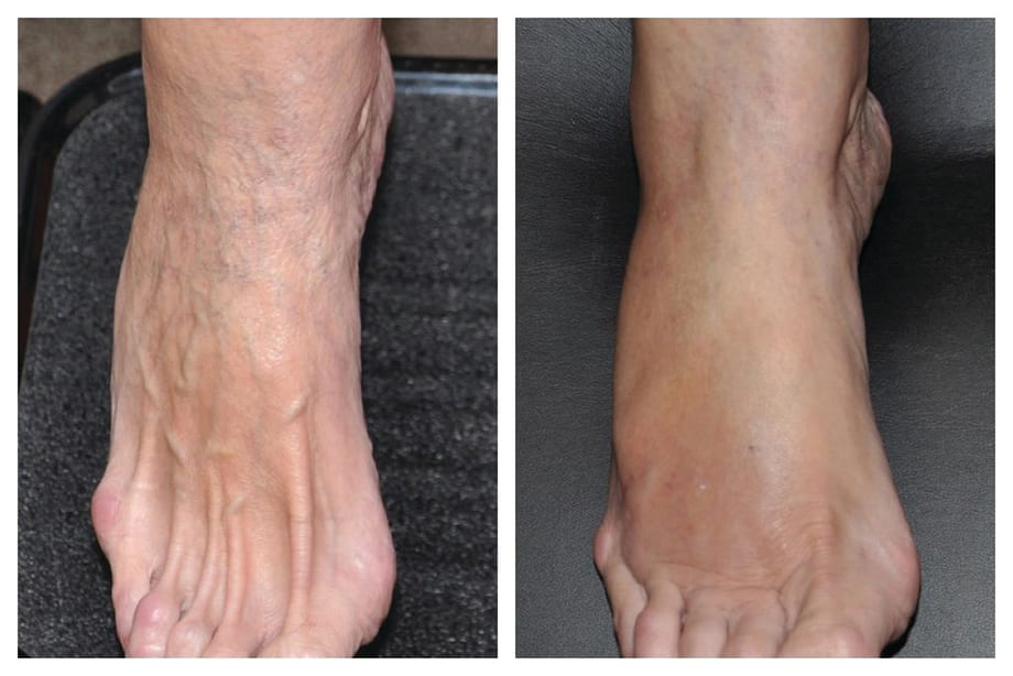 Doctor Gives Feet a Helping Hand