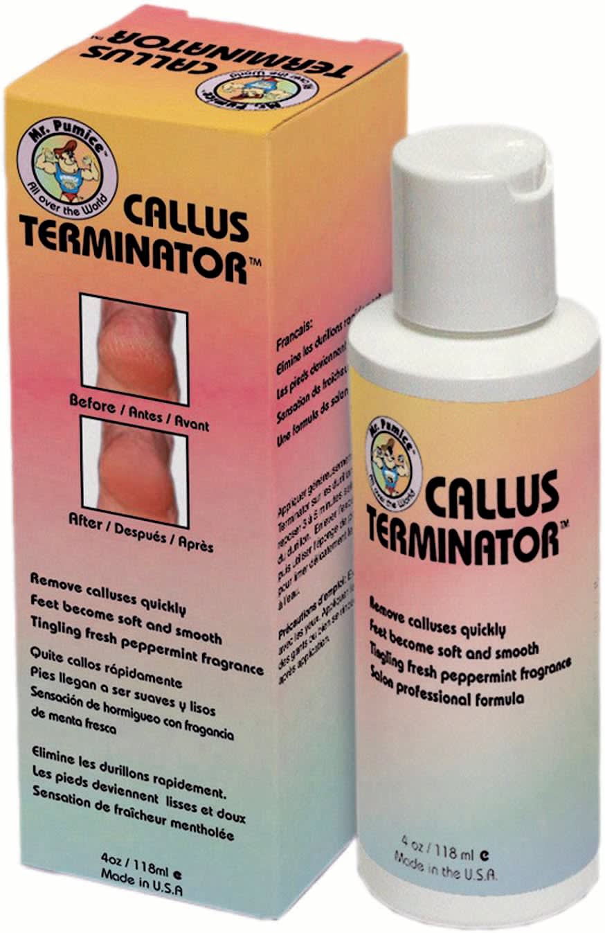 Say, “Hasta la Vista, Baby” to Calluses