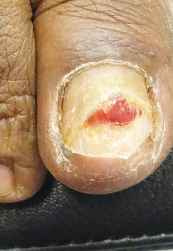 A Day in the Life of a Nail Expert: Mini-Quiz