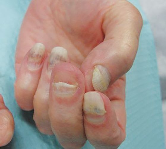A Day in the Life of a Nail Expert: Mini-Quiz