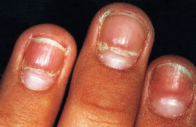 A Day in the Life of a Nail Expert: Mini-Quiz