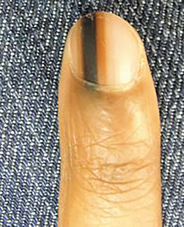 A Day in the Life of a Nail Expert: Mini-Quiz