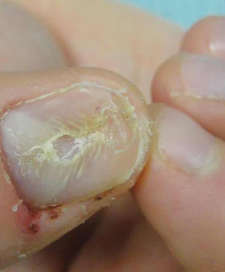 A Day in the Life of a Nail Expert: Mini-Quiz