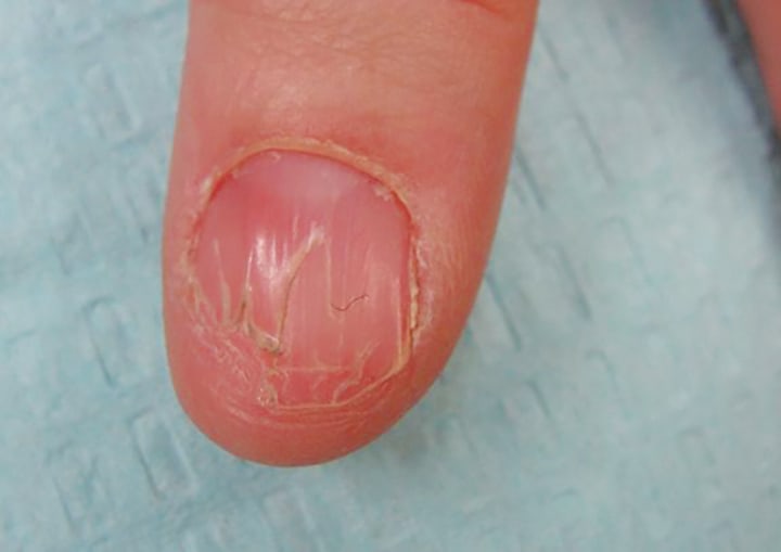 A Day in the Life of a Nail Expert: Mini-Quiz