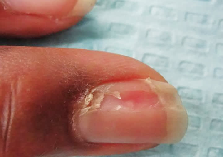 A Day in the Life of a Nail Expert: Mini-Quiz