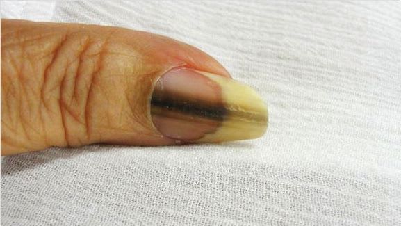 Something to Talk About: Brown Spots