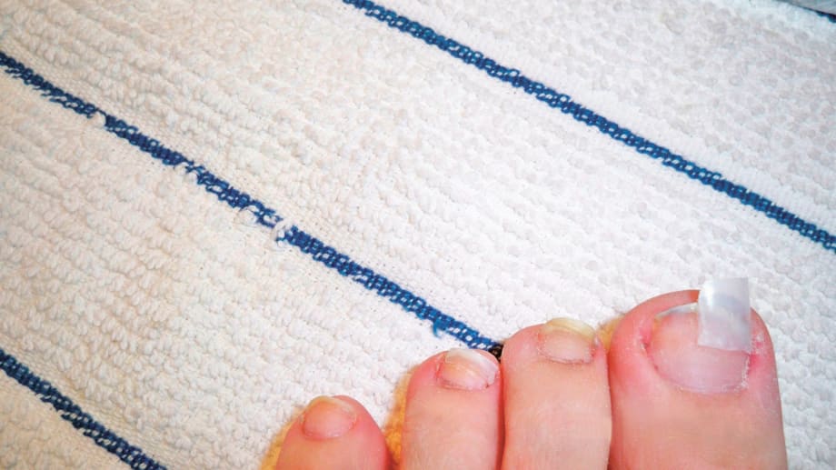 Your Guide to Nail Repairs & Reinforcements