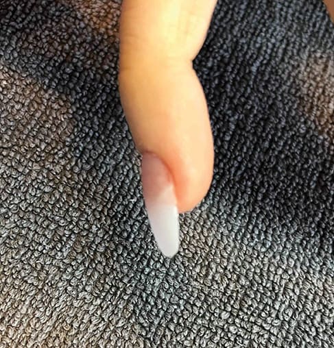 How to Correct Ski Jump Nails