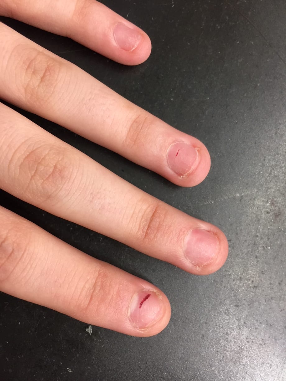 How to Deal With Challenging Nails at a Photoshoot