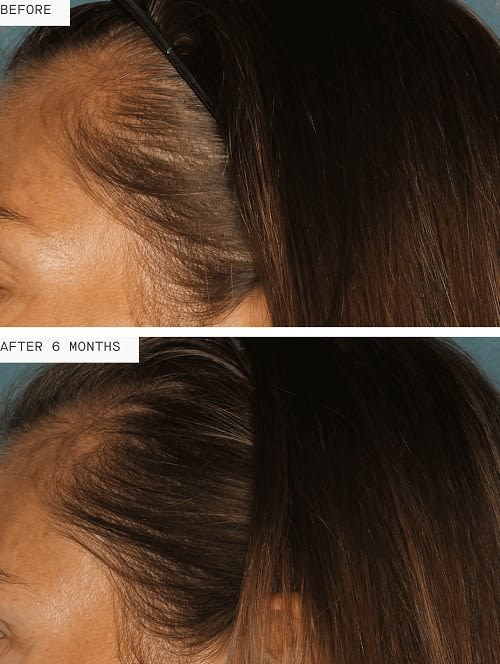 Healthy Abundance: The Nutrafol Approach to Healthy Hair