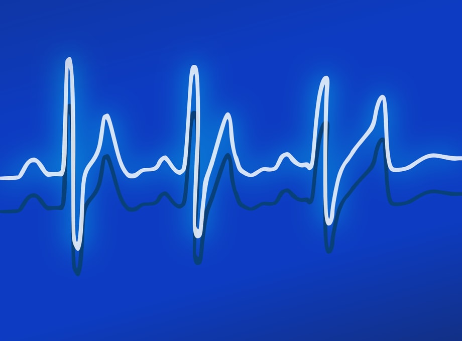 Vehicle Replacement Policy: The Lifeline of Government Fleet Management