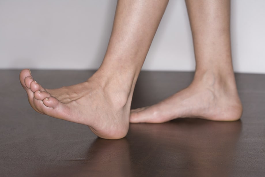 Could You Have Plantar Fasciitis?
