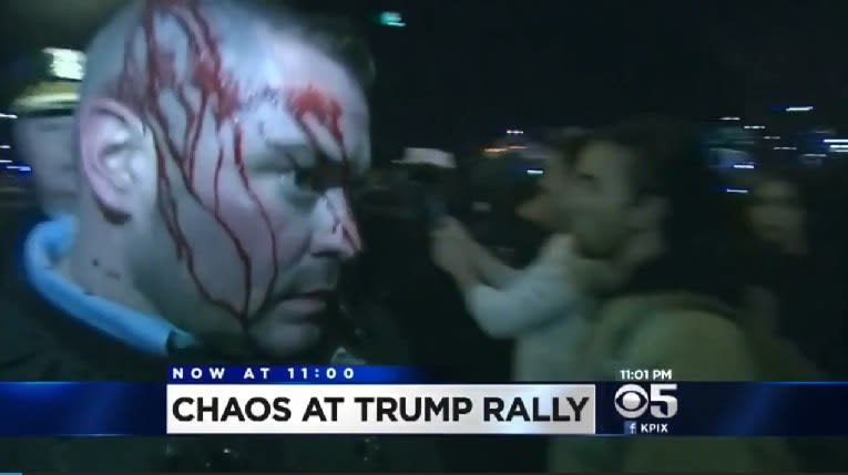 Video: 2 Officers Injured During Trump Rally in Chicago