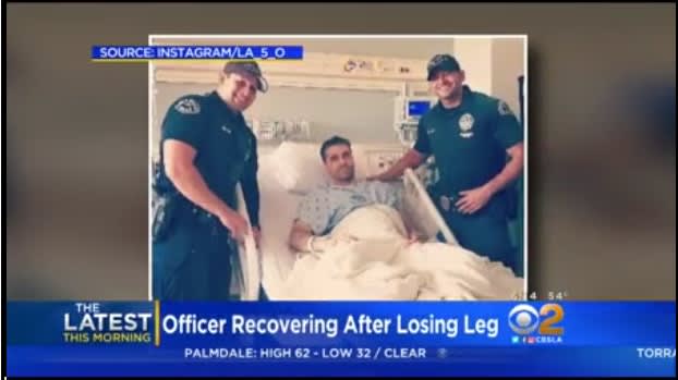 LAPD Officer Lost Leg After Being Struck by DUI Suspect on Freeway