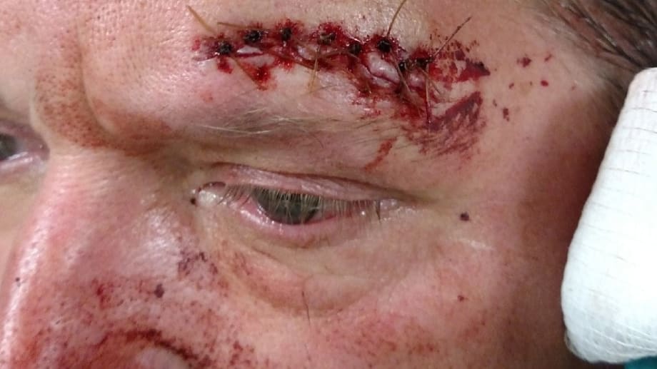 Seattle Officer Injured in Riot Plans to Sue City Over "Inadequate Equipment"