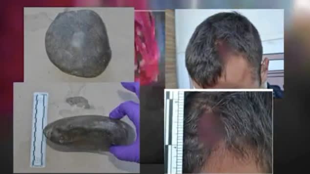 Video: Jane Doe Free After Attack on Albuquerque Officer Because She Can’t be ID’ed