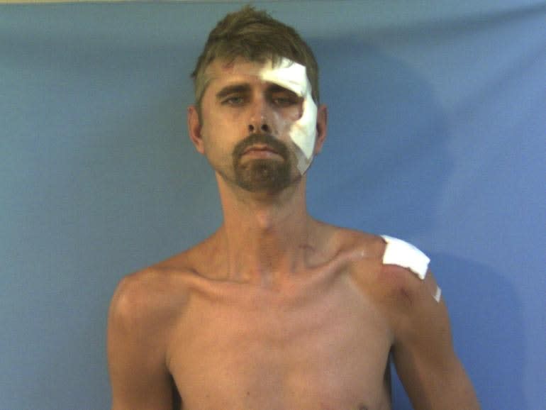 Arkansas Cop Killer Suspect Charged With Capital Murder