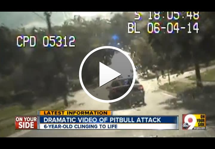 Video: Cincinnati Officers Rescue 6-year-old girl from Dog Attack