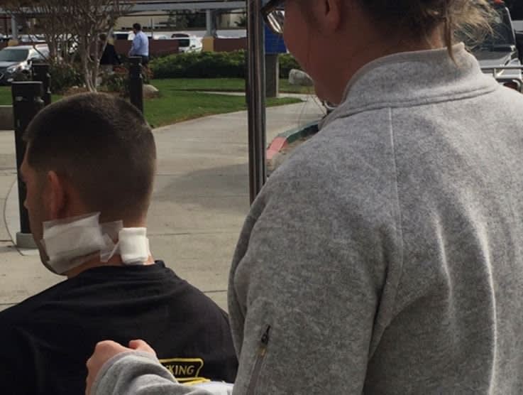 CA Deputy, Suspect Wounded in Tuesday Night Shootout