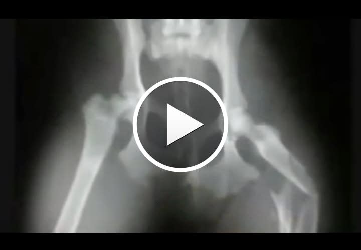 Video: N.M. Man Sues Officers, Agencies, Hospital Over Anal Probes