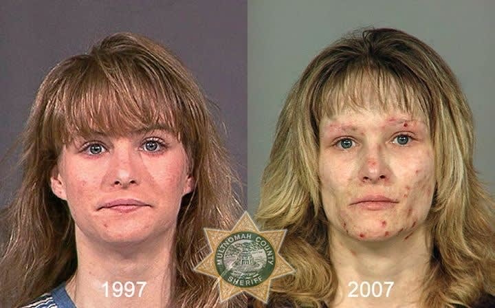 Oregon Sheriff Behind 'Faces of Meth' Creates 'From Drugs to Mugs'