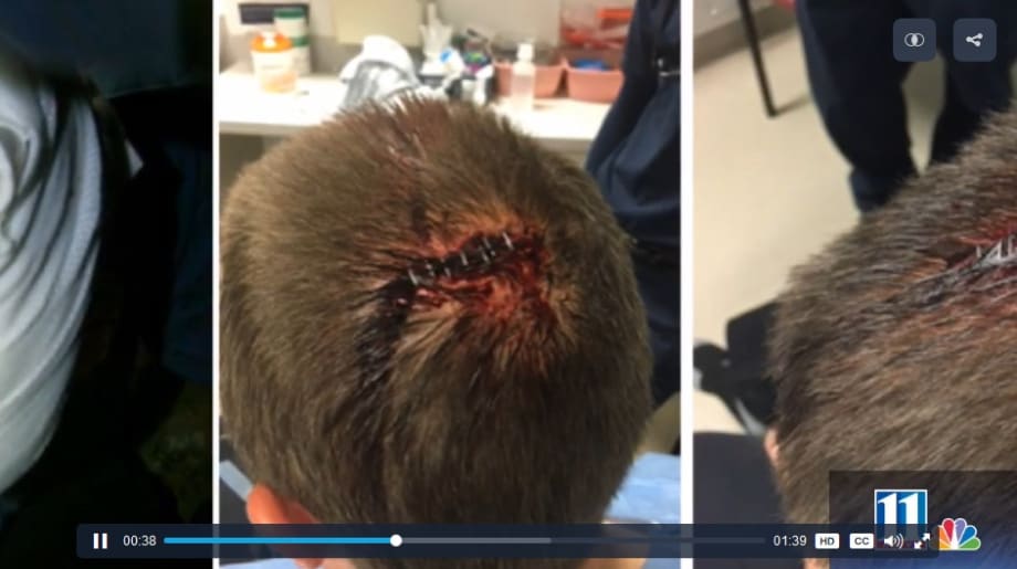 Video: Georgia Officer Arrests Burglary Suspect After Being Beaten with His Own Baton