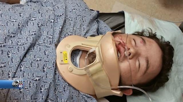 4 Men Arrested in Beating of Alabama Police Supporter