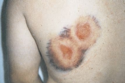 Inside the Labor Rate Debate