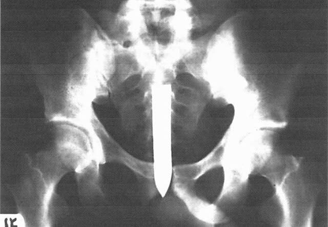 A Devil's Playground for Gang Members