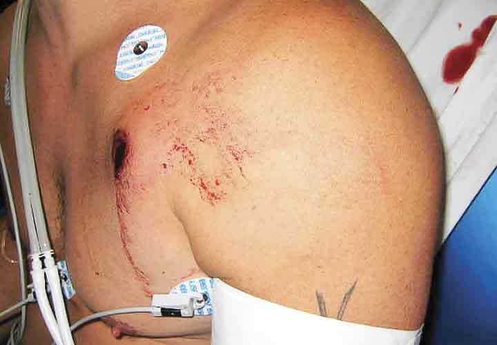 Stopping Power: Myths, Legends, and Realities