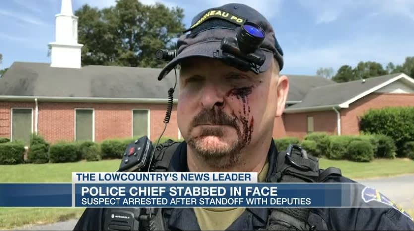 SC Chief Stabbed in Face at Home, Suspect in Custody