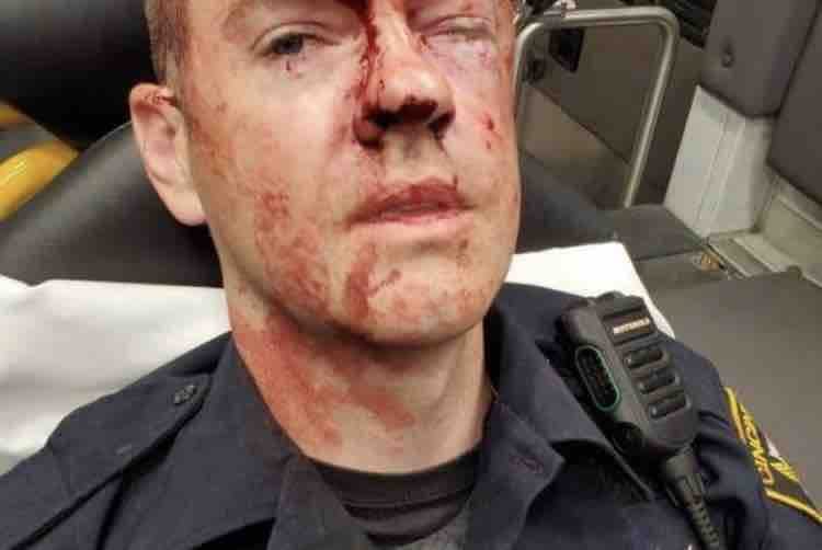 Cincinnati Officer Badly Beaten Making Disorderly Conduct Arrest