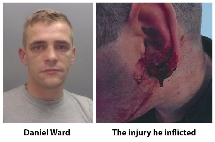 Englishman Who Bit Officer's Ear in 2018 Sentenced to 13 Years