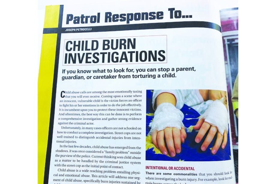 Looking Back: Child Burn Victims, Recruiting Women, and a Female Motor Officer