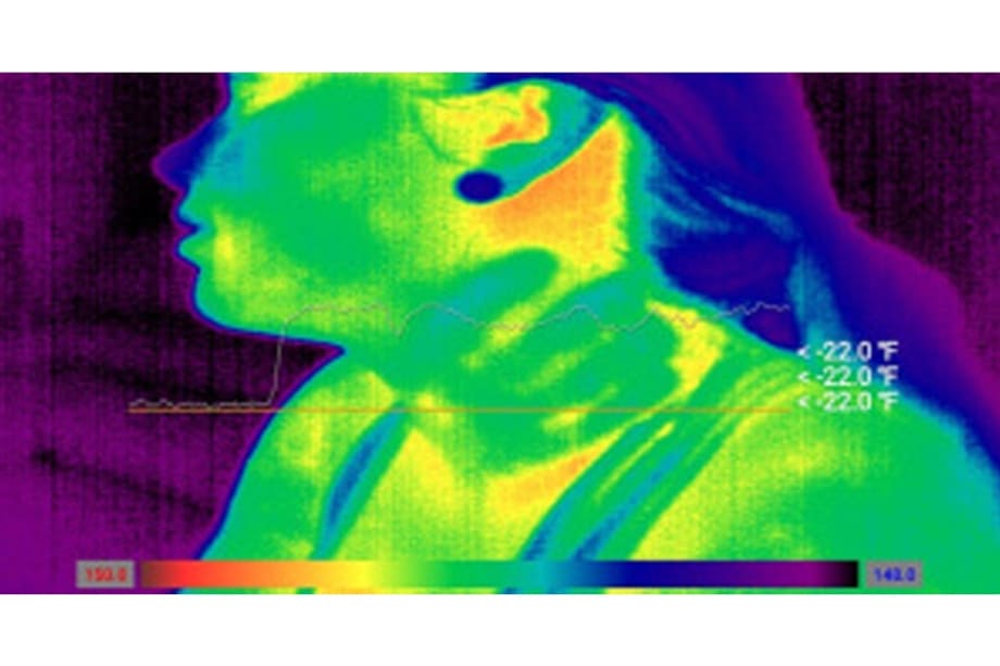 How To Close Assault Cases with Thermal Images