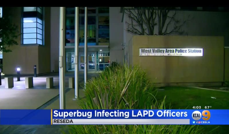 3 LAPD Officers Get MRSA from Contact with Homeless Subject, Union Says