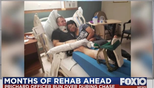 AL Officer Hit by Patrol Vehicle During Foot Pursuit Faces Long Rehab