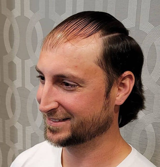 Hair Loss Meets Its Match: Celso Enrique Rivera on the Joy of Hairskeen