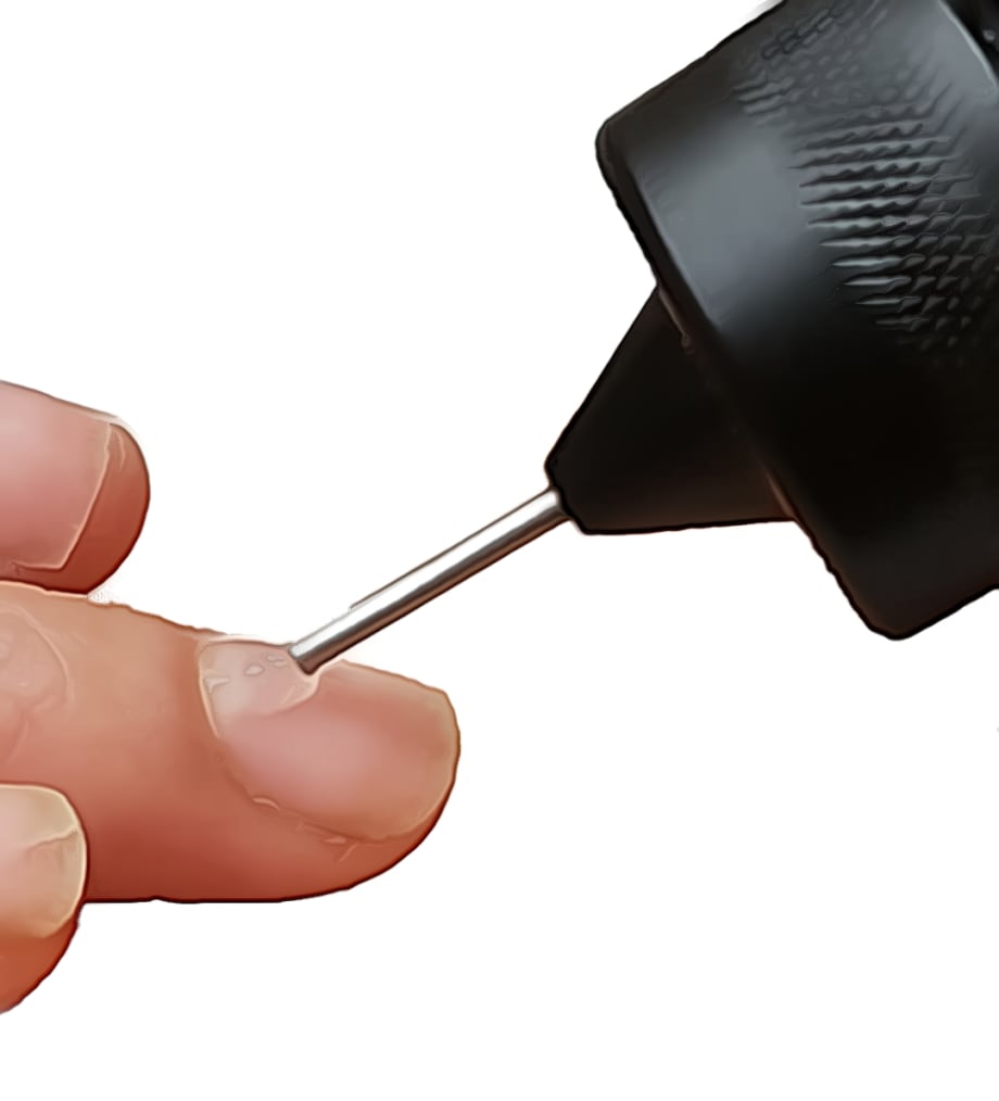 Innovative Xtens Precision Nozzle for Gel Is a Game-Changer