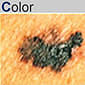 July is UV Safety Month