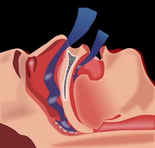 FMCSA Medical Board to Review Comments on Sleep Apnea Pre-Rule