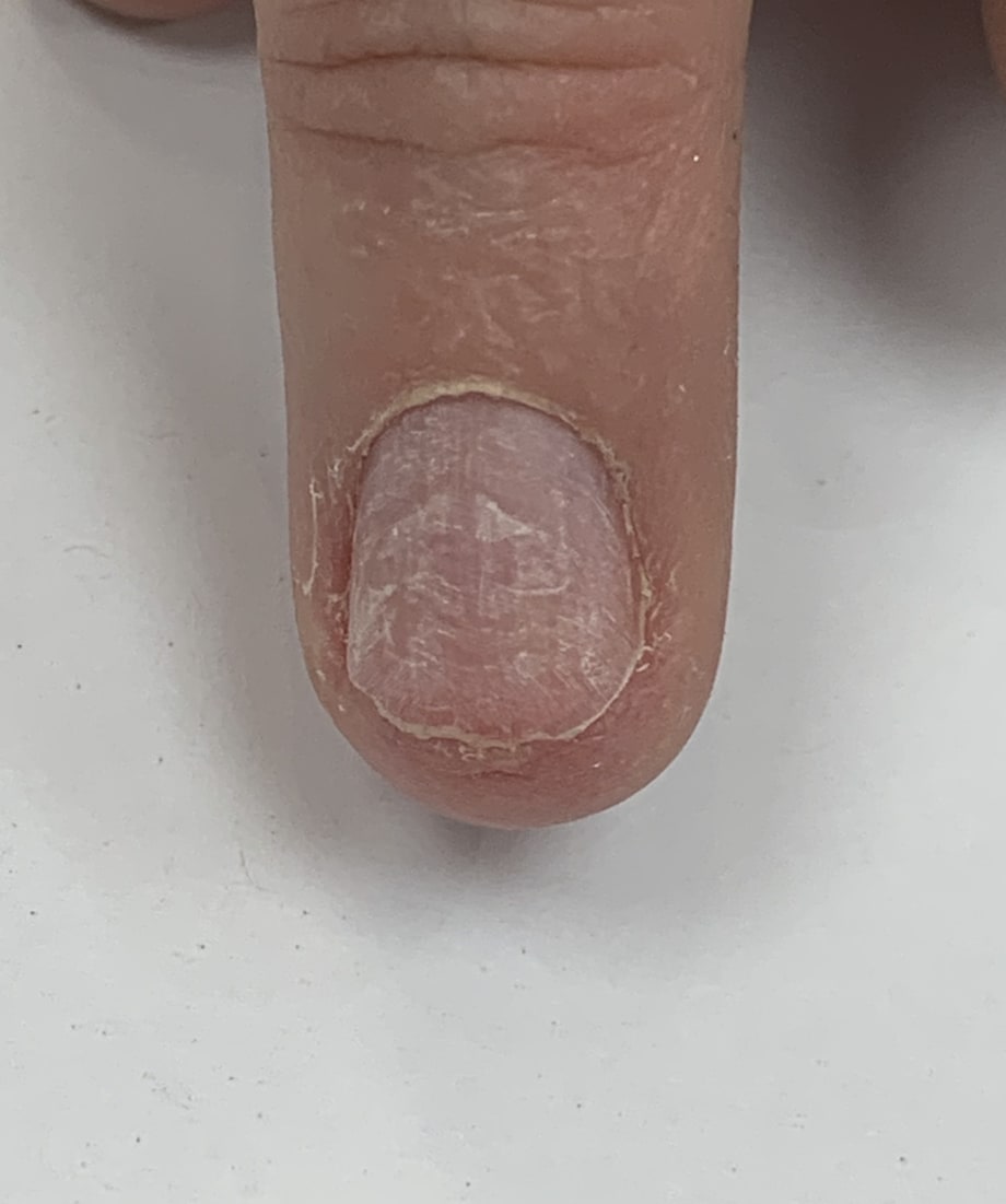  How to Tailor a Nail Form and Create a Ballerina Shape for a Nail Biter
