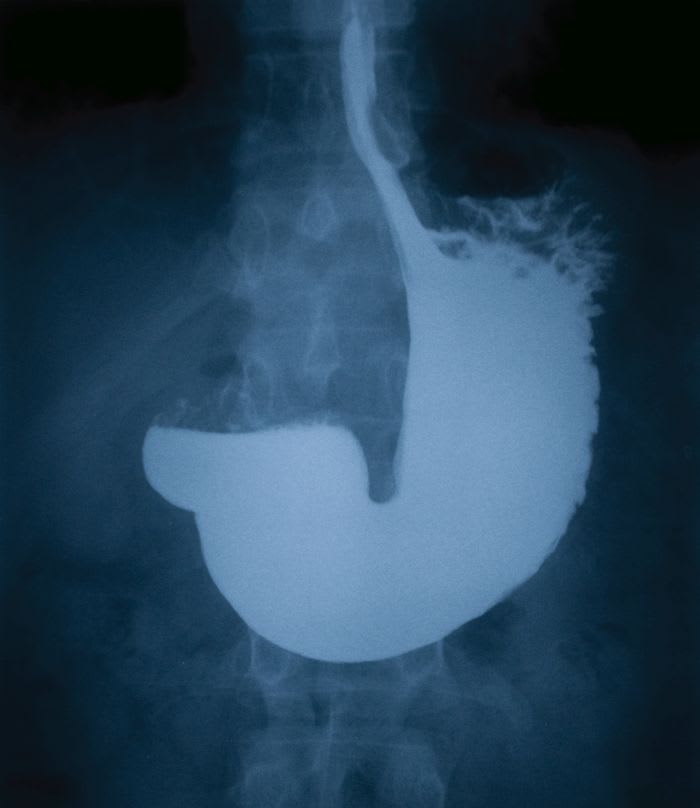 Your Culture Is Causing Stomachaches