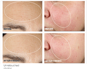 Skincare Clients Can Prepare for Fall with StriVectin