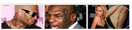 Top Reasons For Tattoo Removal