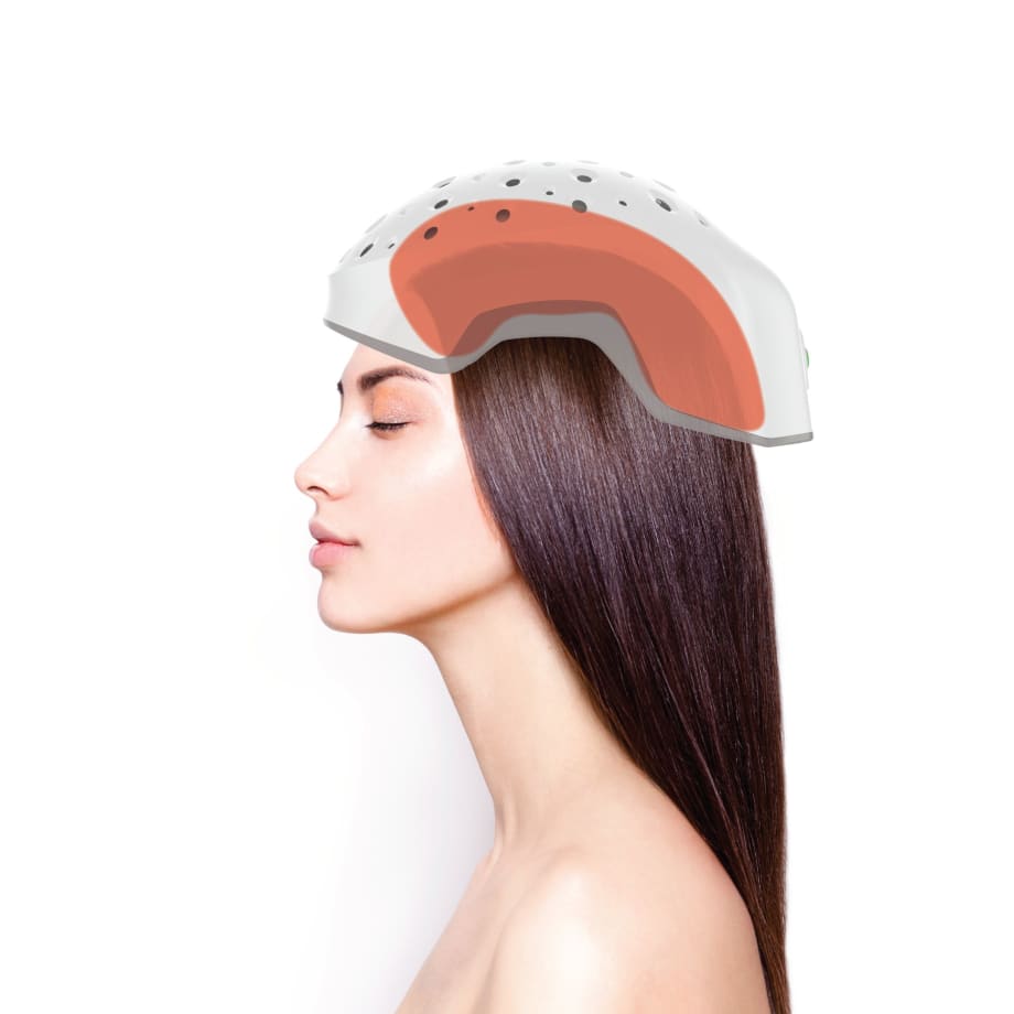 Hair Loss Help from Cool Laser Technology