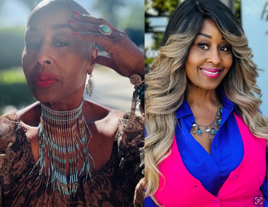 Helen Owens, alopecia survivor and hair replacement expert