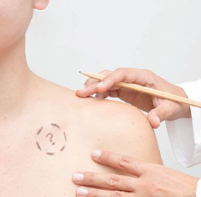 Be Your Guests' First Line of Defense Against Skin Cancer